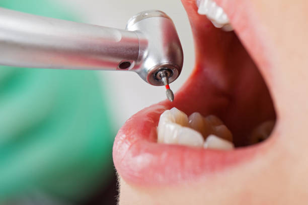 Best Emergency Cosmetic Dentistry (e.g., broken veneers) in Bay Point, CA